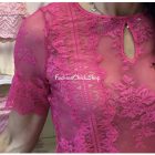 Intimissimi csipke body